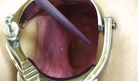 Sal-most, kot darmowe filmy pporno